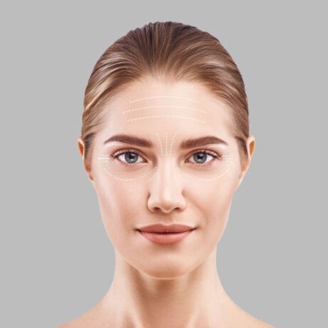 Cheeks Threads Lift Treatment price in Pakistan, Lahore, Islamabad,