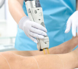 Full Legs Hair Removal Laser Treatment