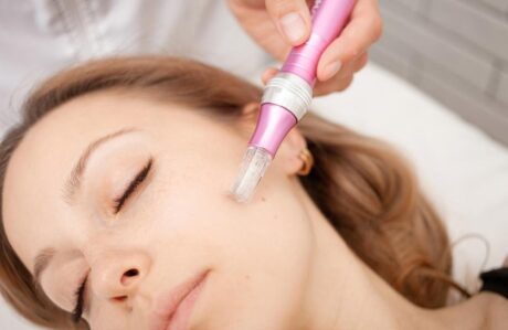 Microneedling Procedure in Pakistan