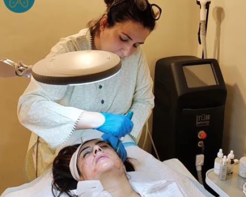 Microneedling Treatment Cost in Pakistan, Islamabad By Dr Shafaq Ramay
